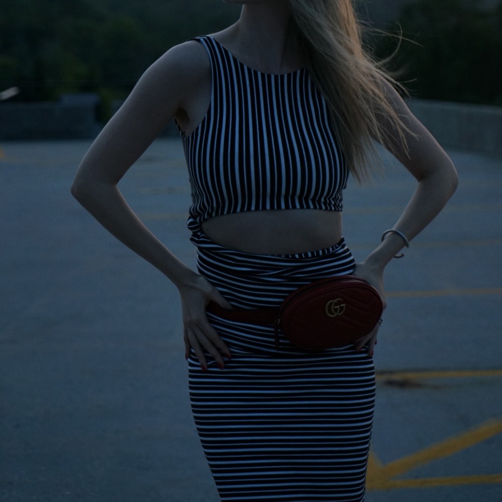 Zara Cut Out Striped Dress - Picture 9 of 9